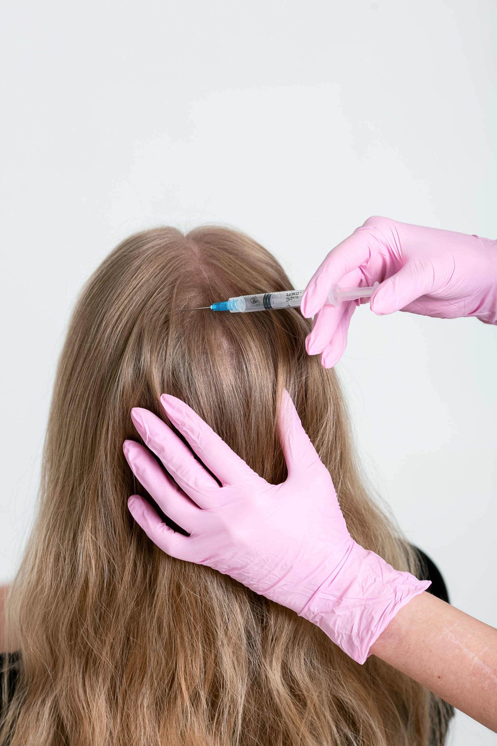 инъекционное лечение волос