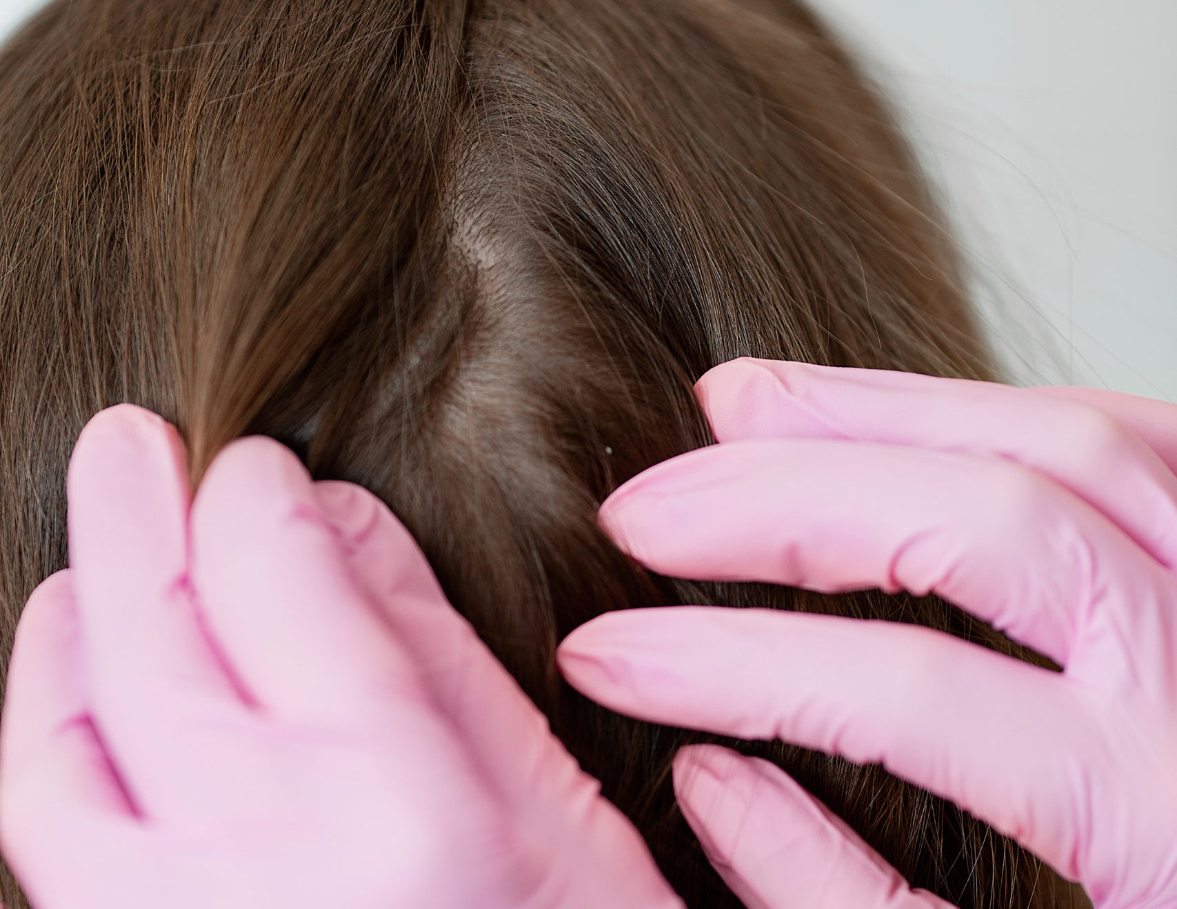 Список необходимых анализов при выпадении волос в ЦИДК